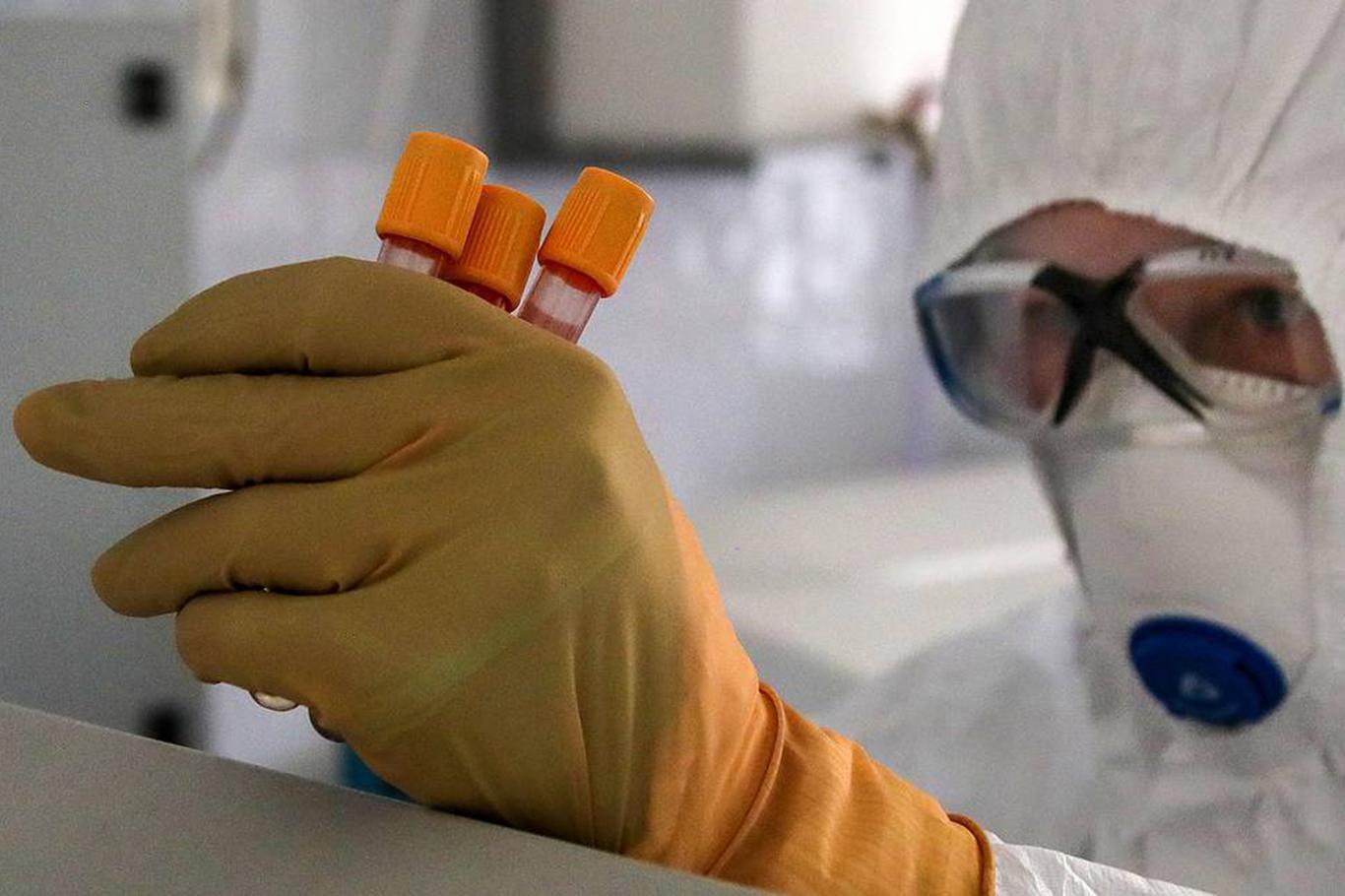 Brazil reports 1086 deaths from coronavirus in the past 24 hours